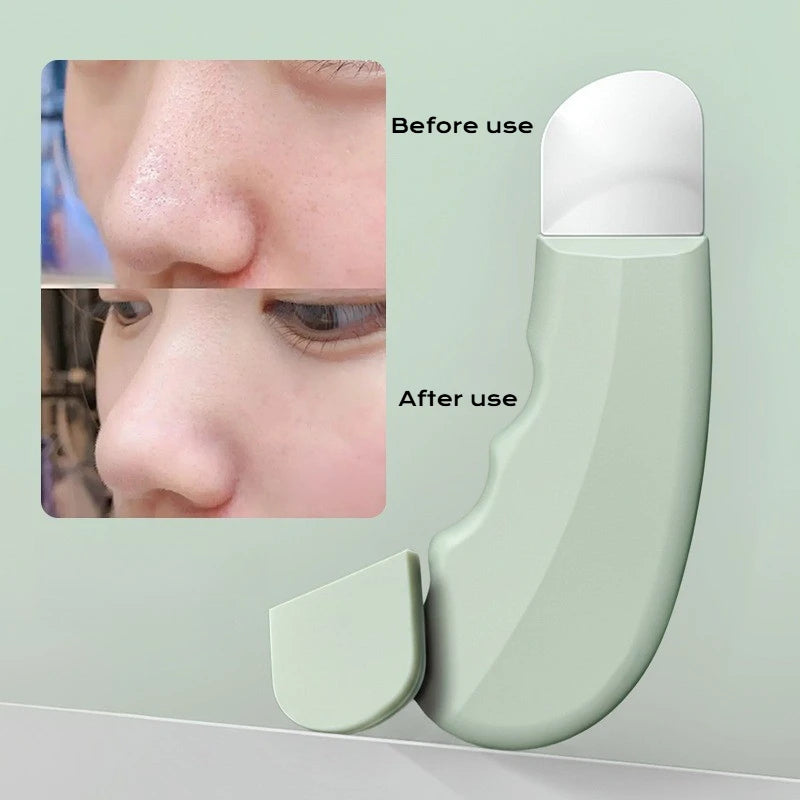 Deep Cleansing Blackhead and Whitehead Removal Tool for Nose and Face - Skin Pore Cleaner Skin Care Beauty Tools Hot Sale