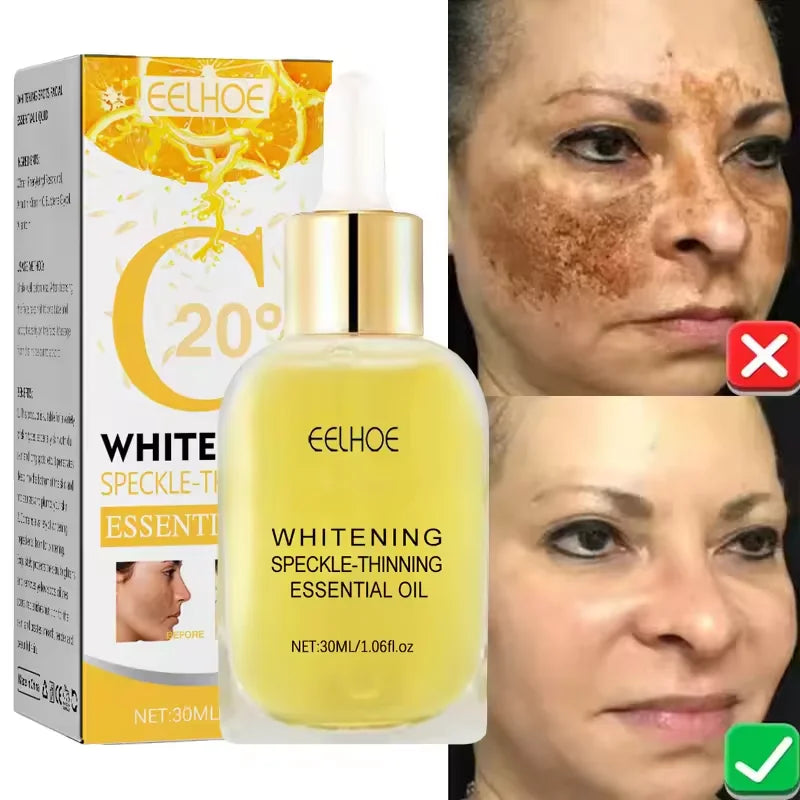 Whitening Freckle Serum Melanin Correcting Fade Pigment Remove Melasma Moisturizing Dark Spot Brighten Beauty Skin Care Essence