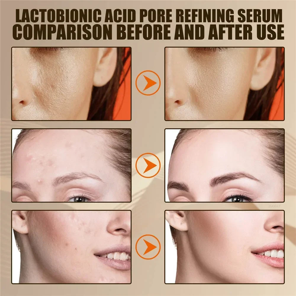 EELHOE Lactobionic Acid Pore Shrink Face Serum Skin Repair Clean Blackheads Acne Skin Care Lasting Moisturizing Korean Cosmetic