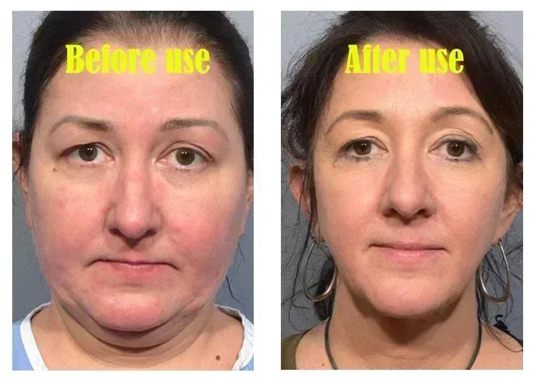 3RD  V-Shape Face Slimming Lifting Facial Cream Lift Up V Double Chin Cheek Slimming Firming Anti Wrinkle Beauty Skin Care