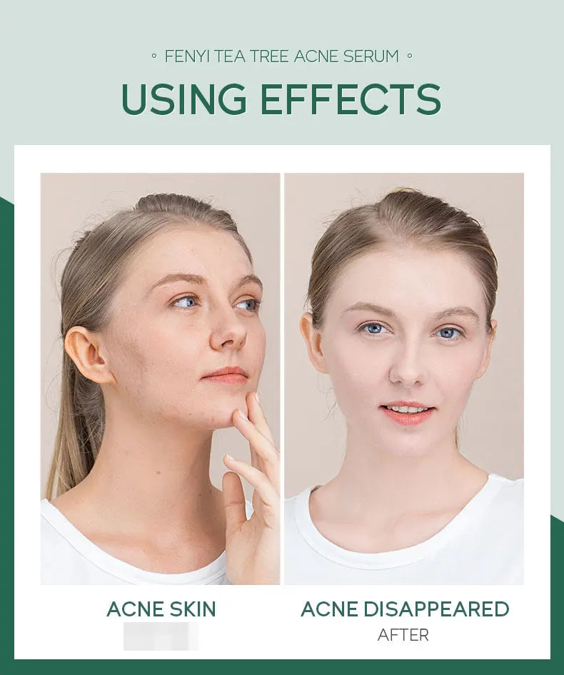 LAIKOU TEA TREE Face Serum Oil-control Anti-Aging Shrink Pores Acne Treatment Whitening Moisturizing Tea Tree Essence Skin Care