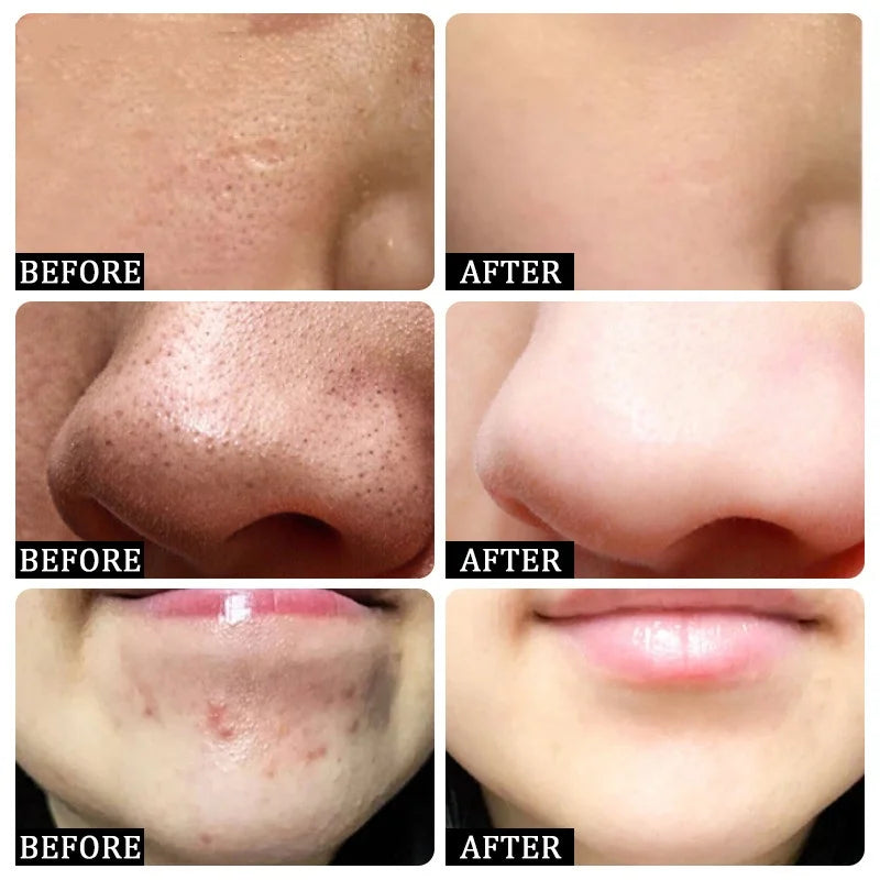 Blackhead Remover Mask Bamboo Charcoal Shrink Pores Acne Black Head Removal Cream Nose Cleansing Black Peel Off Masks Skin Care