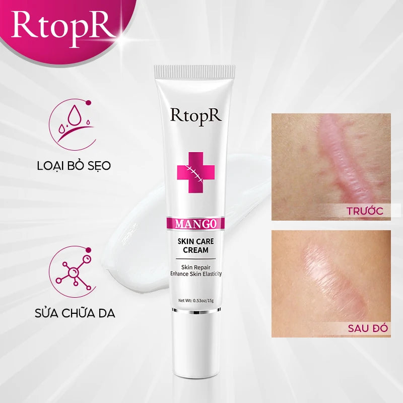 RtopR Mango Skin Cream Whitening and Moisturizing Skin Rejuvenation Nourishing Skin Care