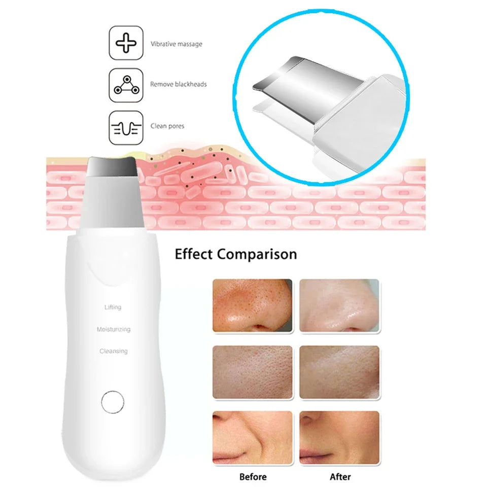 Facial Skin Scrubber Face Spatula Exfoliator Deep Cleansing Blackhead Remover Facial Lifting Cleaning Not Ultrasonic Skin Care