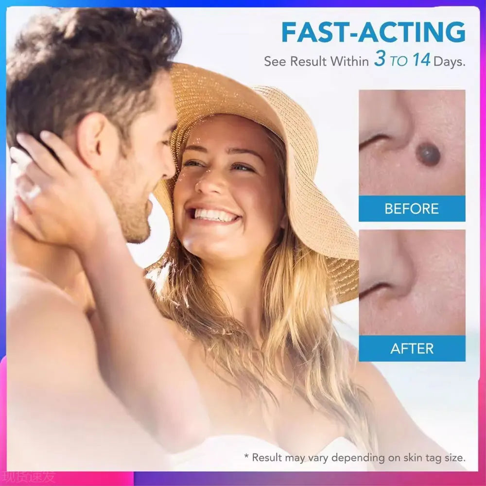 Skin Tag Removal Trade Double Head Wart Remover Pen Kit Home Use Face Skin Care Tool