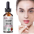 Moisturizing Rosehip Oil Oil Massage Skin Care Plant Essential Oil Moisturizing Whitening Essential Oil
