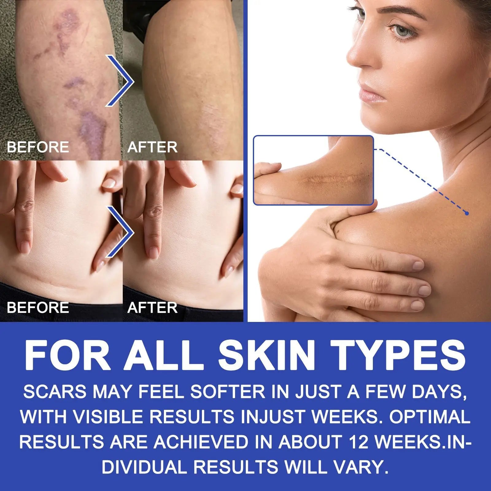 Auto Skin Tag Mole Wart Removal Face Skin Care Body Kit Painless Cleaning Tool Wart Dot Treatment for 2-8mm Beauty Health 2 In1