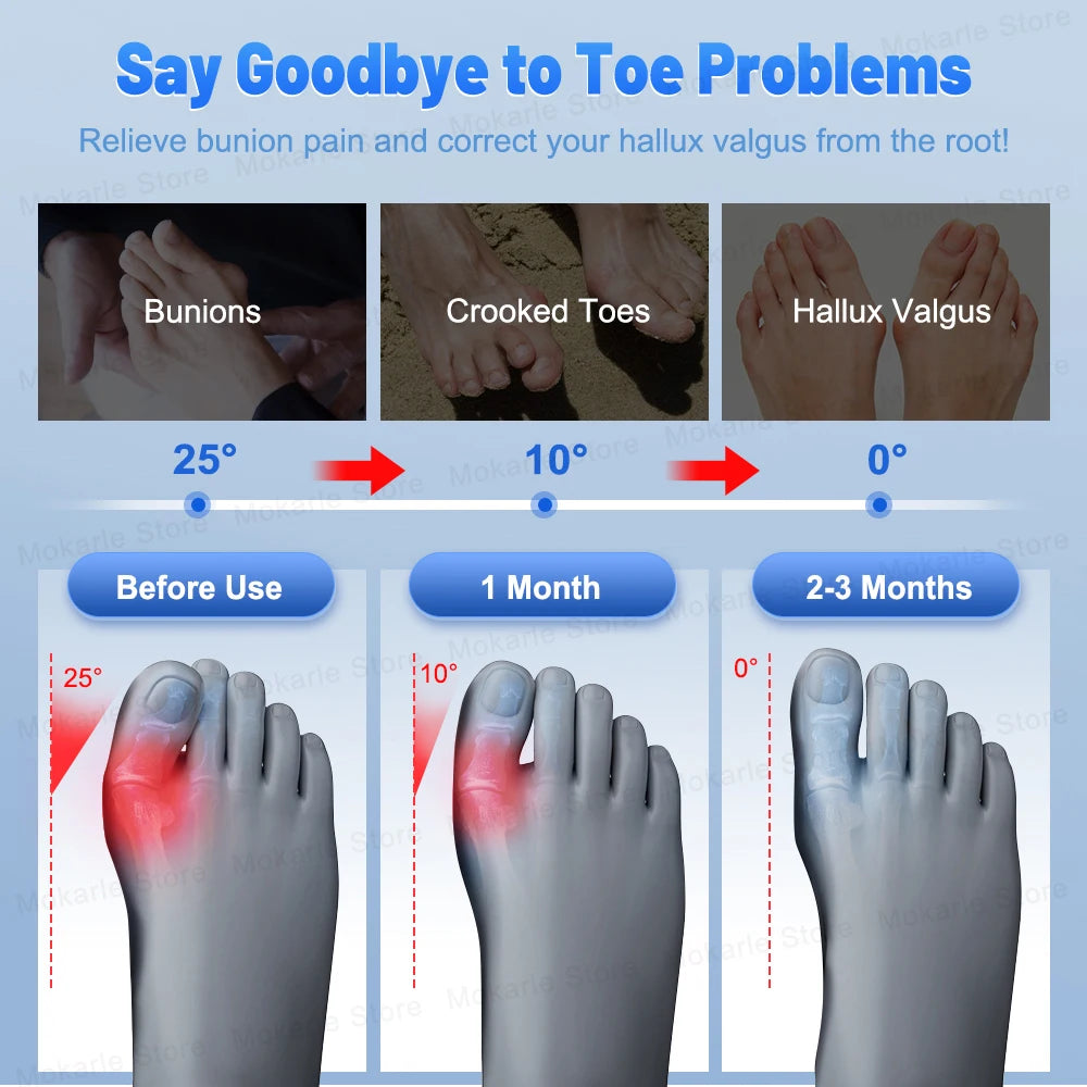 Toe Correction for Left Right Hallux Valgus Corrector Bunion Straightener Adjustable Thumb Big Toe Orthopedic Pedicure Foot Care