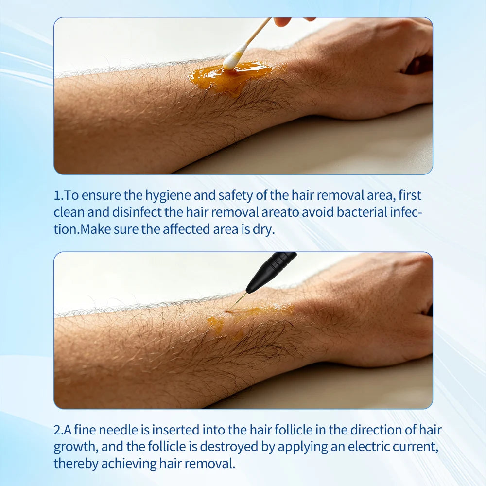 Professional Permanent Electrolysis Hair Removal Machine Painless Needle Epilation