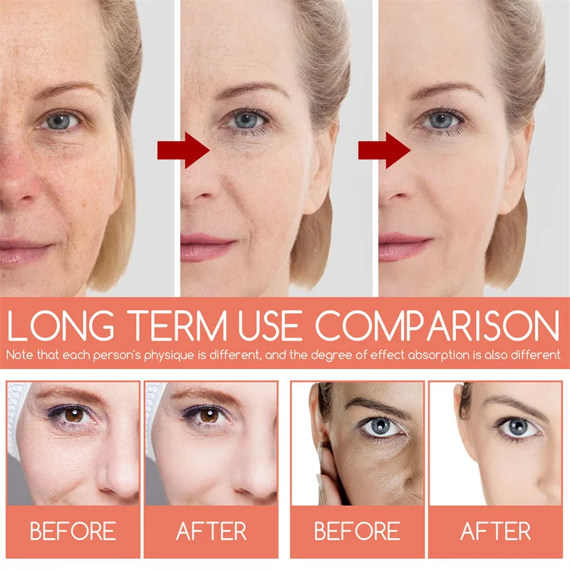 Retinol Wrinkle Remover Face Cream Firming Lifting Anti Aging Fade Fine Lines Moisturizing Whitening Repair Skin Care Cosmetics