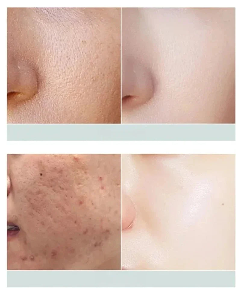 White Black Rice Exfoliating Serum Peel Shot Facial Moisturizing Soften Blackhead Removal Hydrating Shrink Pores Skin Care Korea