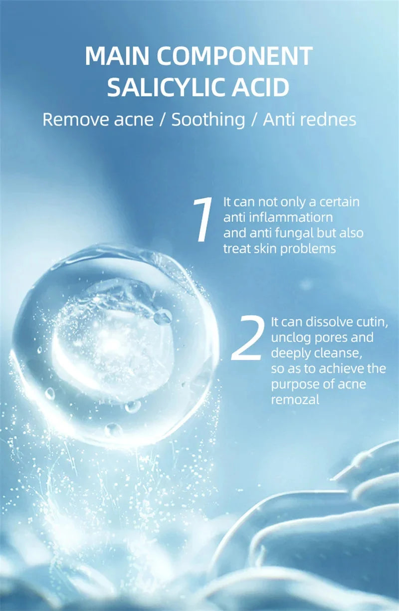 Acne Cream For Face Pimples Remover Treatment Shrink Pores Oil Control Lighten Acne Marks Whitening Smoothing Facial Skin Care