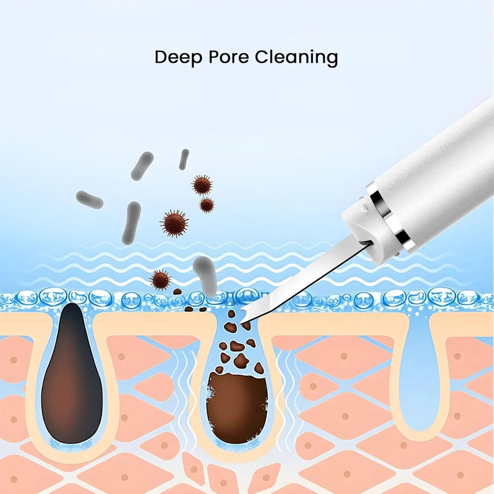 Ultrasonic Skin Scrubber Vibration Face Spatula Blackhead Remover Shovel Clean Cavitation Peeling Facial Lifting Skin Care