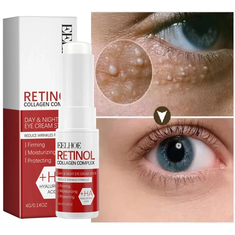 Fat Granules Removal Eyestick Anti-Puffiness Firming Cream Anti Inflammatory Fade Fine Line Repair Skin Barrier Korean Skin Care