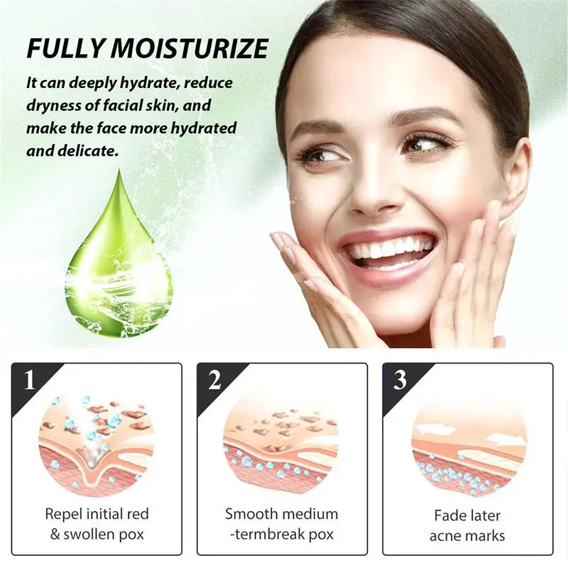 Natural Herbs Acid Acne Cream Shrink Pores Blackheads Scars Acne Marks Blemishes Oil Control Whitening Korean Skin Care Products