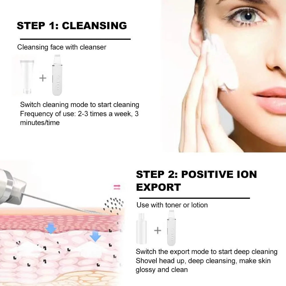 Ultrasonic Skin Scrubber Vibration Face Spatula Blackhead Remover Shovel Clean Cavitation Peeling Facial Lifting Skin Care