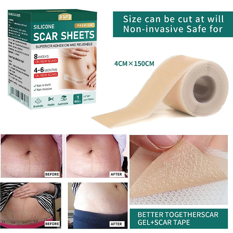 New 1 Roll Silicone Scar Sheets Gel Scar Patch 4cmX150cm Self-Adhesive Scar Cover Tape Reusable And Effective Skin Care Strips
