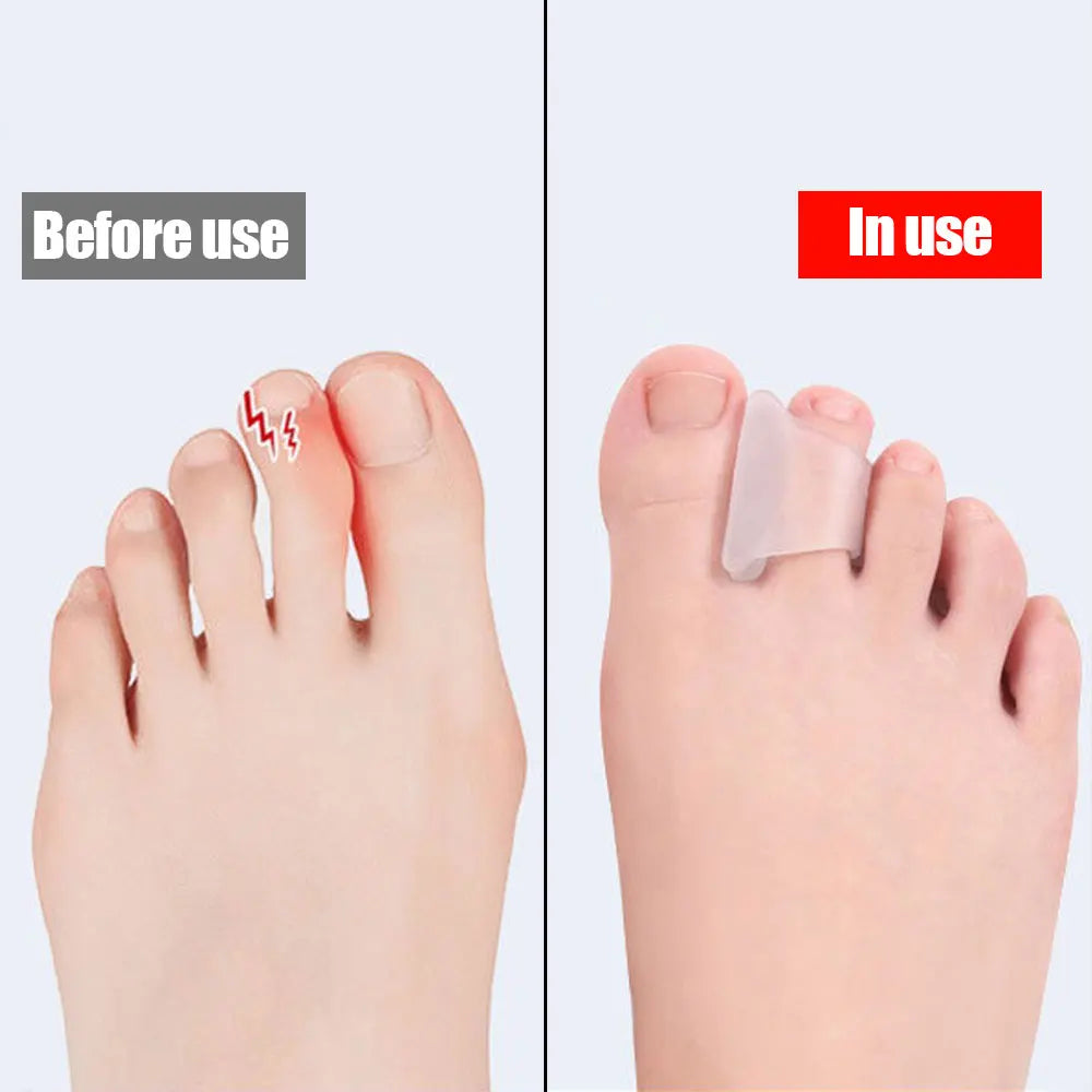 2Pcs Hammer Toe Corrector Hammertoe Straightener for Curled Crooked Bent Claw and Overlapping Toes Bunion Pads Protective Pad