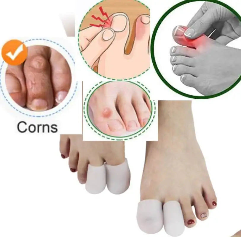 1/10/100Pairs Big Toe Caps Gel Toe Covers Protect from Rubbing Ingrown Toenails Corns and Blisters Foot Care Protectors