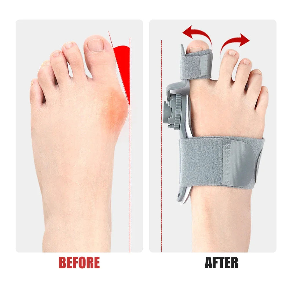 Bunion Corrector for Women & Men - Adjustable Knob Brace with Toe Separator & Anti-Slip Heel Strap, Big Toe Pain Relief (1PC)