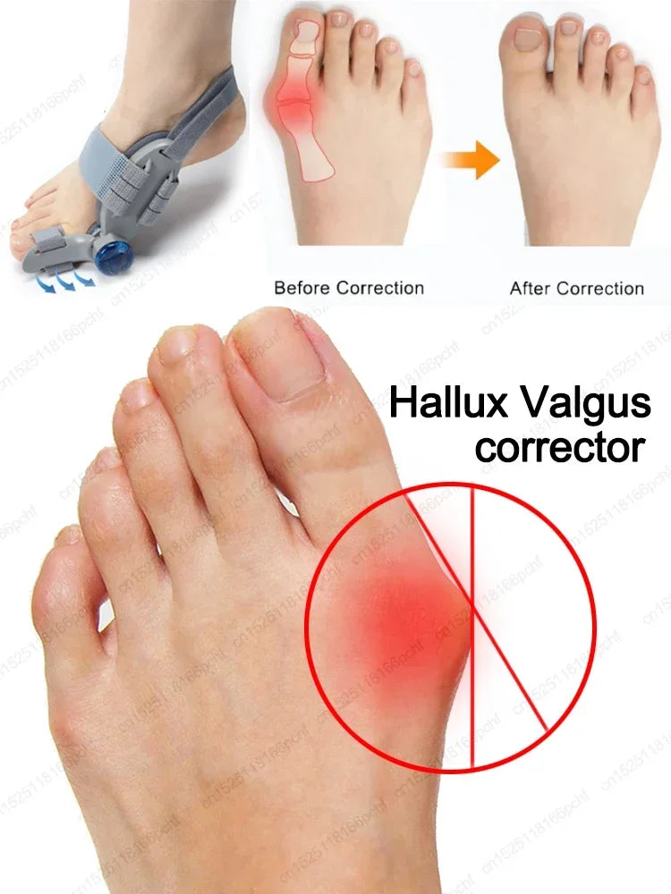 Bunion Splint Big Toe Straightener Hallux Valgus Correction foot corrector Orthopedic Corrector Pedicure Bunion Protector Toes