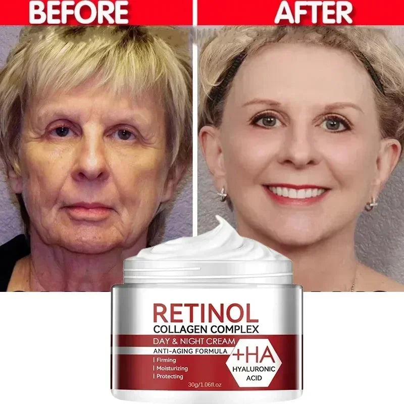 Retinol Wrinkle Remover Face Set Instant Firming Lifting Anti-Aging Serum Fade Fine Lines Whitening Korean Skin Care Products