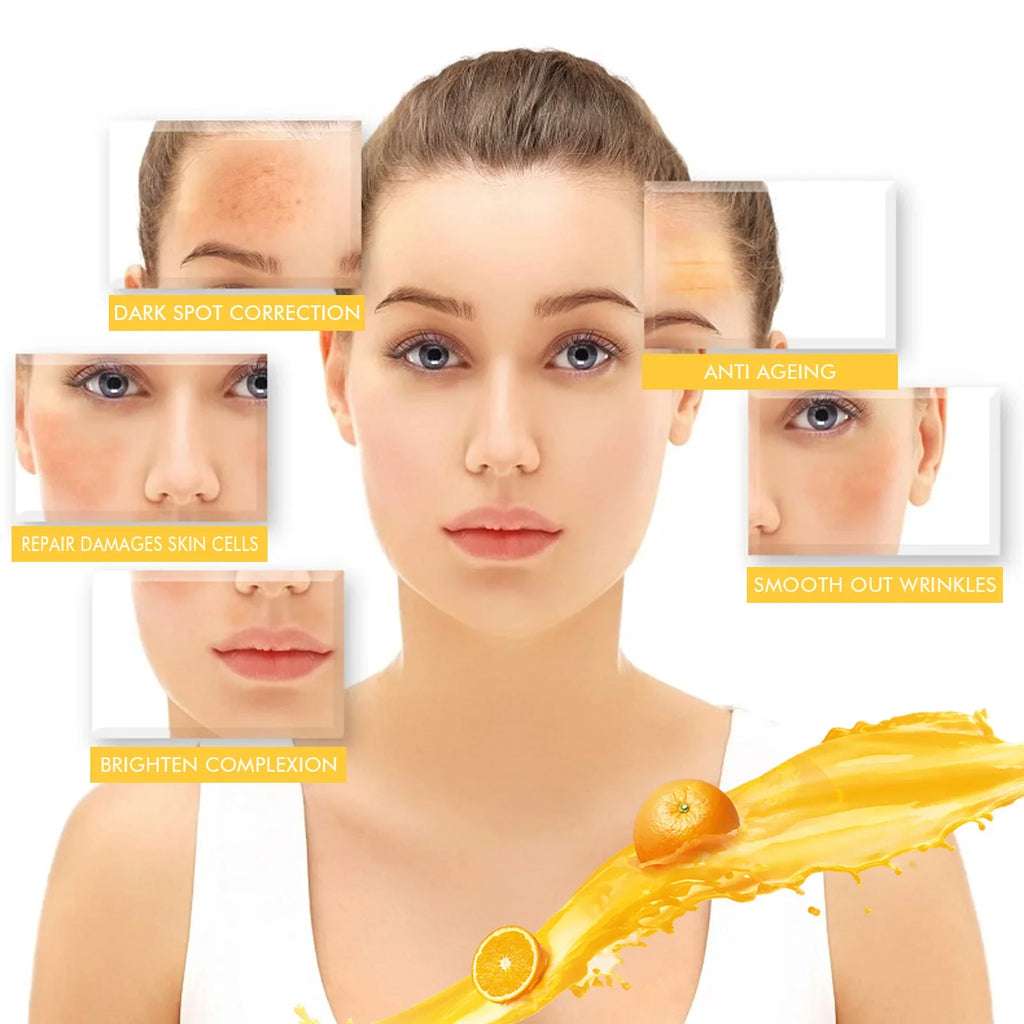 Whitening Freckle Serum Melanin Correcting Fade Pigment Remove Melasma Moisturizing Dark Spot Brighten Beauty Skin Care Essence