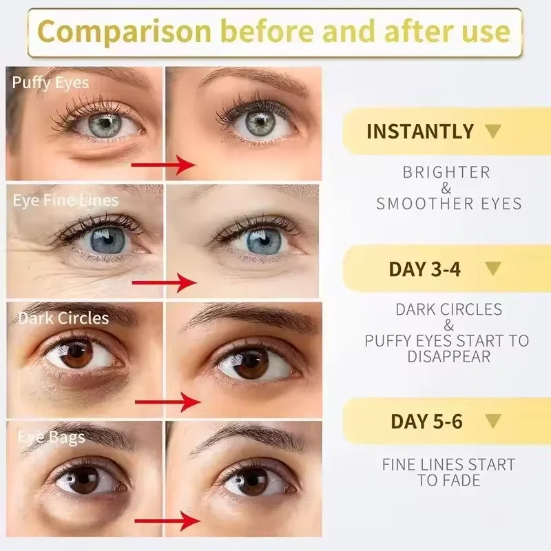 Fat Granules Removal Eyestick Anti-Puffiness Firming Cream Anti Inflammatory Fade Fine Line Repair Skin Barrier Korean Skin Care