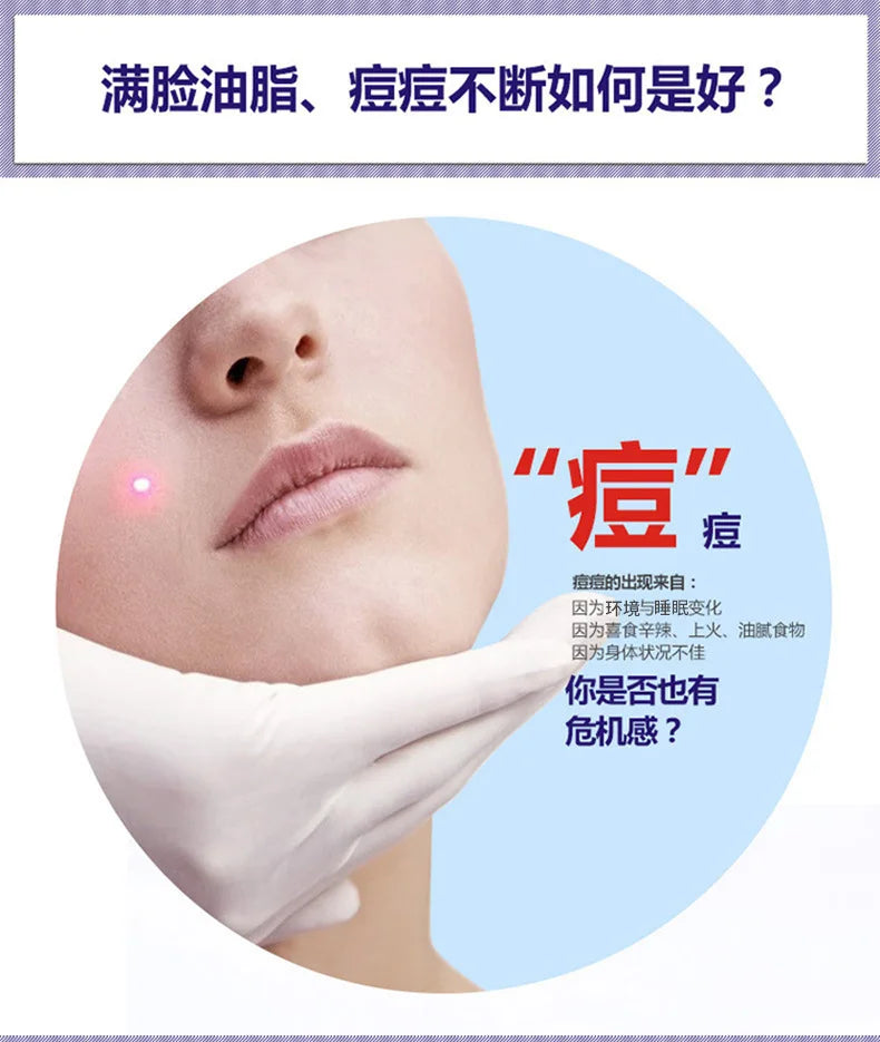 Treatment Cream Face Acne Remover Repair Gel Oil Control Serum Shrink Pores Whitening Facial mask Skin Care Korean Cosmetic
