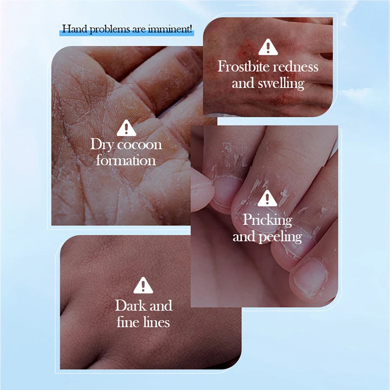 SADOER Coconut Moisturizing Hand Mask Whitening Nourishing Anti-aging Hydrating Hand Gloves for Hands Skin Care Products