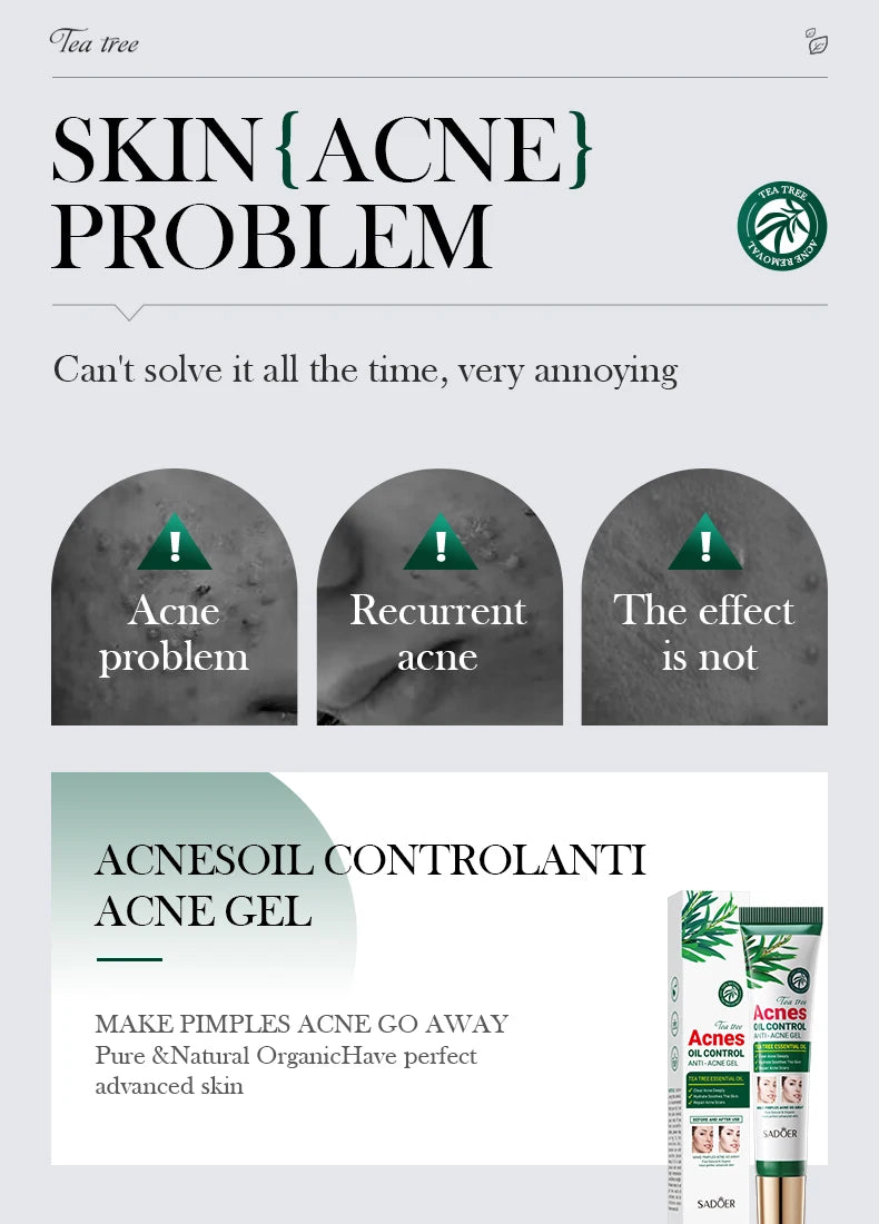 Tea Tree Acne Removing Cream Facial skincare Oil Control Face Gel Creams Hydrating Moisturizing Facial Cream Skin Care Set