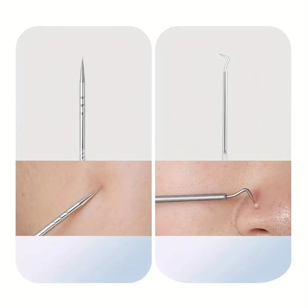 Stainless Steel 4/7/8pcs Acne Removal Tool Set - Blackhead