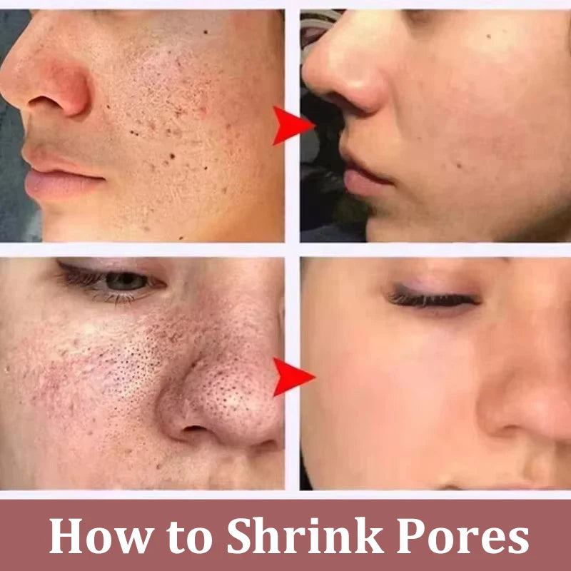 White Black Rice Exfoliating Serum Peel Shot Facial Moisturizing Soften Blackhead Removal Hydrating Shrink Pores Skin Care Korea