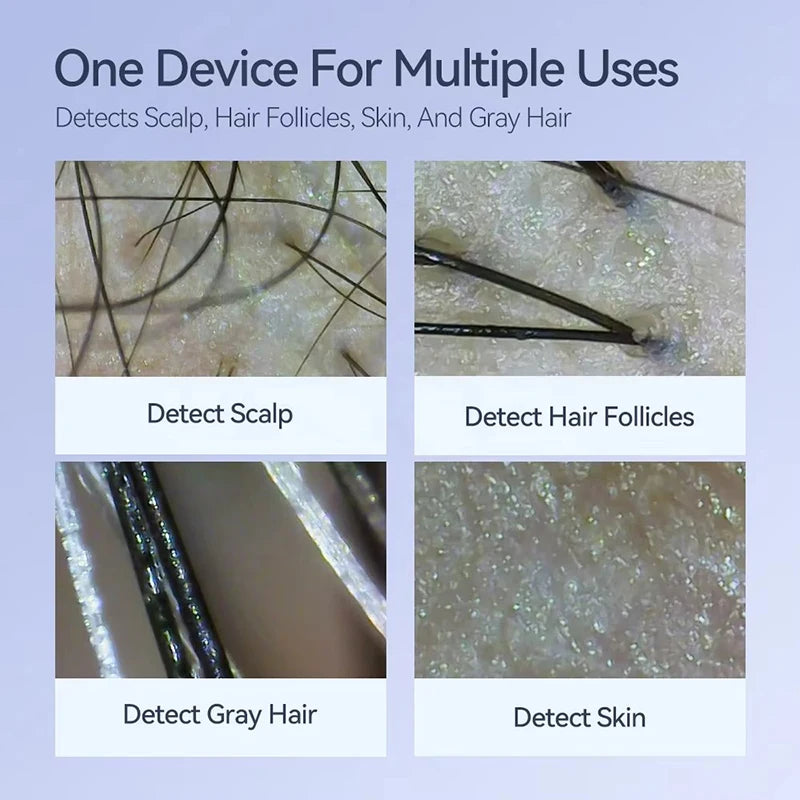New Skin Hair Scalp Detector Dermatoscope Tester Digital HD 50X /200X Skin Analyzer Machine For Scalp Diagnostic Skin Care Tools