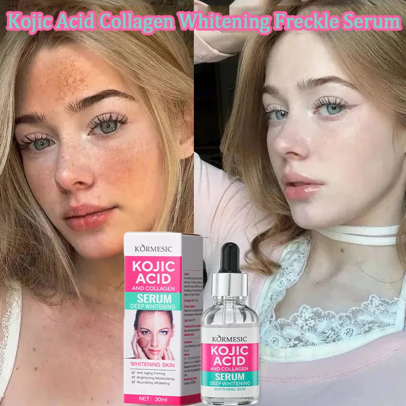 Kojic Acid Collagen Whitening Freckle Serum Remove Dark Spots Fade Melasma Melanin Brighten Repair Dull Face Skin Care Cosmetics