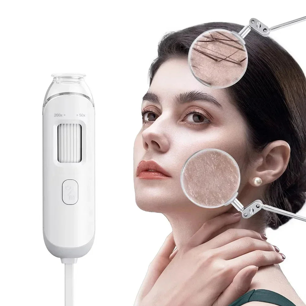 New Skin Hair Scalp Detector Dermatoscope Tester Digital HD 50X /200X Skin Analyzer Machine For Scalp Diagnostic Skin Care Tools