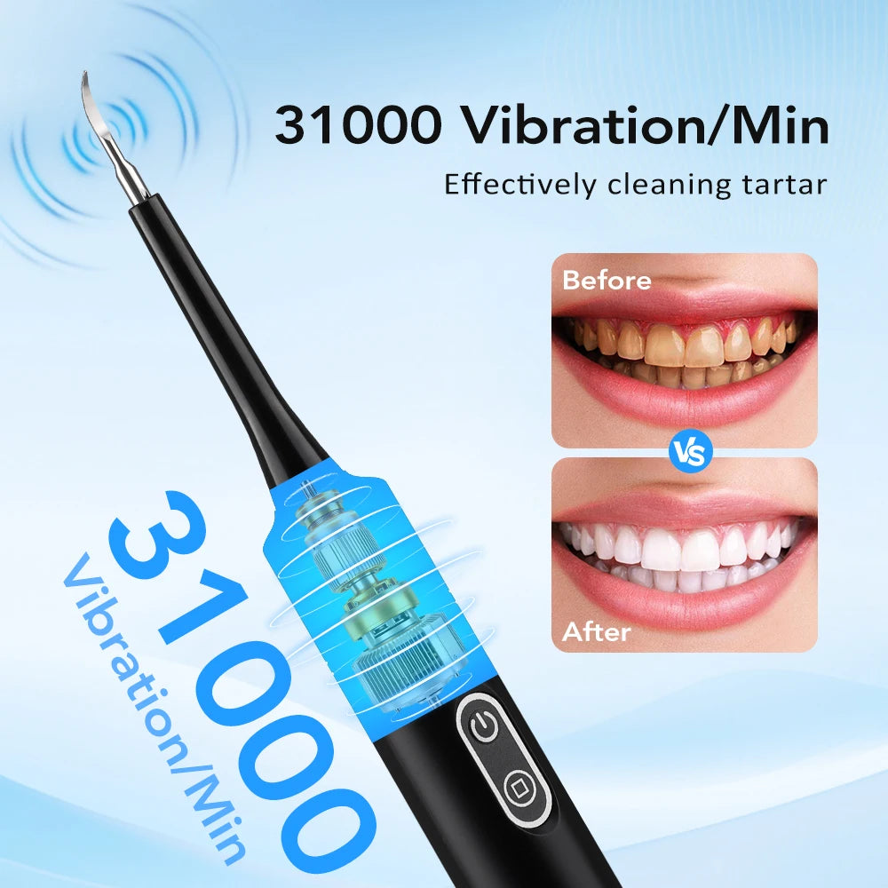 Electric Dental Scaler with Teeth Brush Head Calculus Tartar