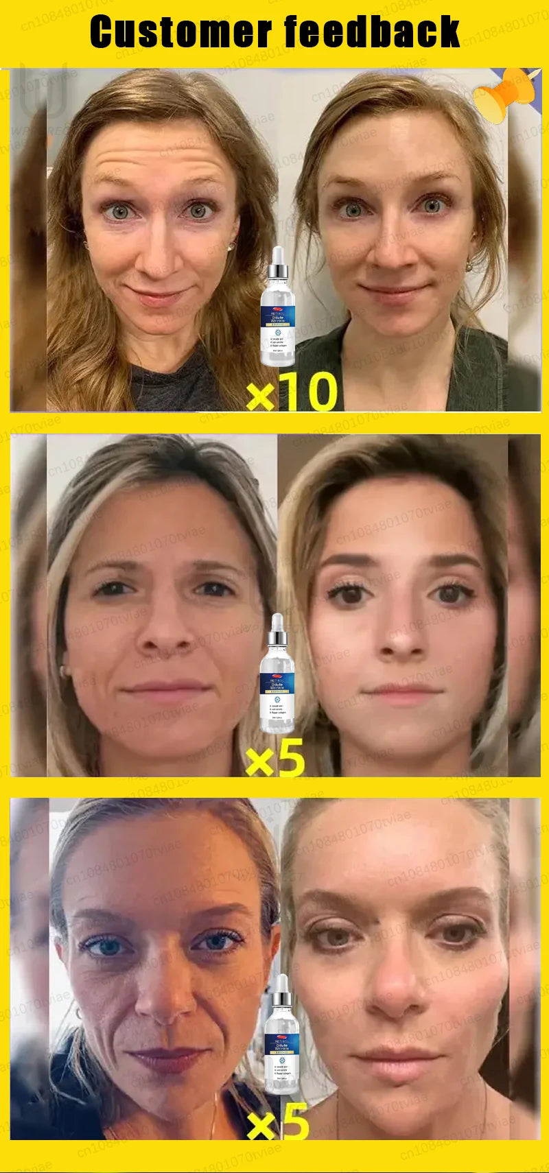 Anti-wrinkle facial essence anti-aging anti-wrinkle essence brightening and firming whitening moisturizing skin care