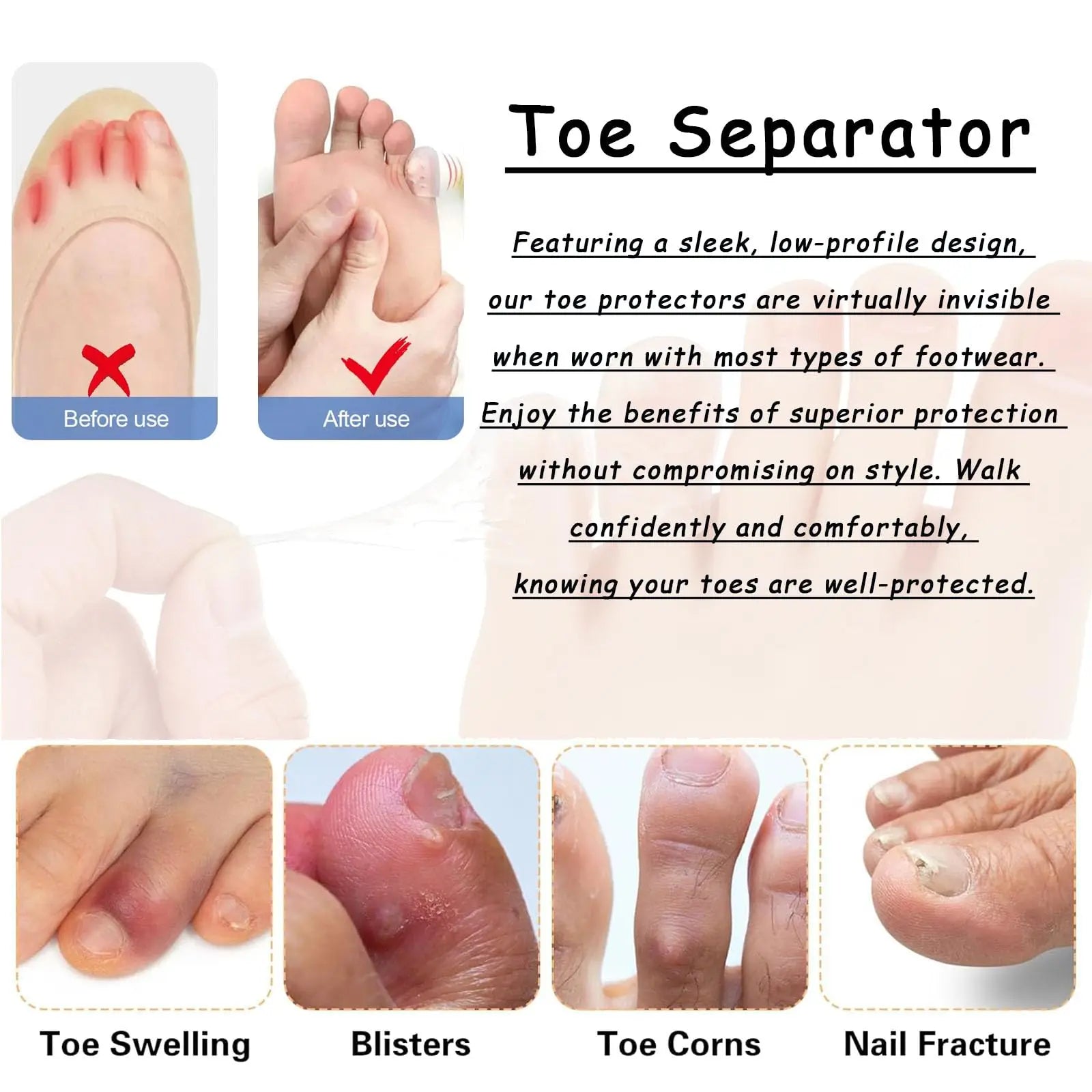 20pcs Toe Protectors Silicone Gel Caps for Corns Calluses Blisters Pain Relief, Soft Toe Sleeves Cushions