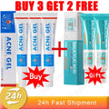 Salicylic Acid Acne Treatment Face Cream Repair Pimple Spots Deep Cleaning Pore Anti-acne Scar Oil Control Moisturizer Skin Care