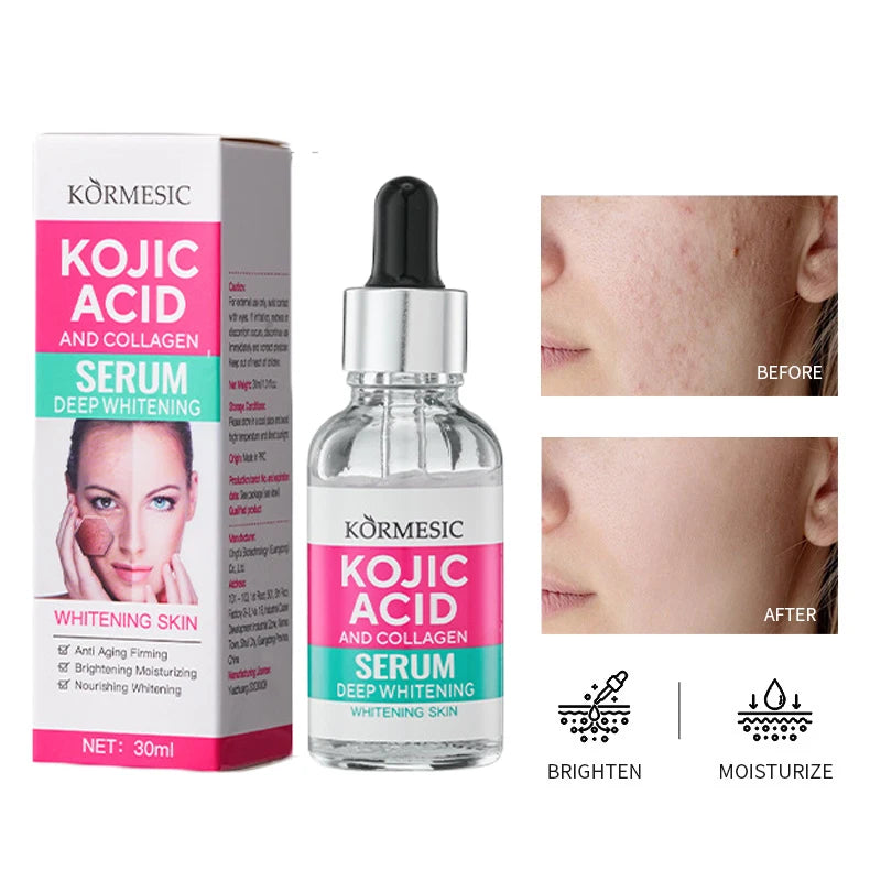 Kojic Acid Collagen Whitening Freckle Serum Remove Dark Spots Fade Melasma Melanin Brighten Repair Dull Face Skin Care Cosmetics