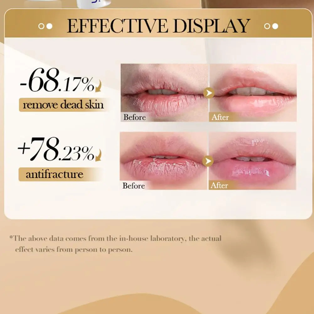 SADOER 5/10/15PCS Collagen Lip Balm Lasting Moisturizing Anti Wrinkles Hydrating Lipstick Lips Skin Care Products