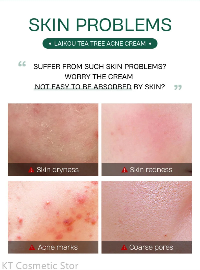 LAIKOU Tea Tree Serum 17ml Anti-Acne Cream 20g Cleanser 50g Plant Extract Refreshing Hydrating Moisturizing Skin Care Set Beauty