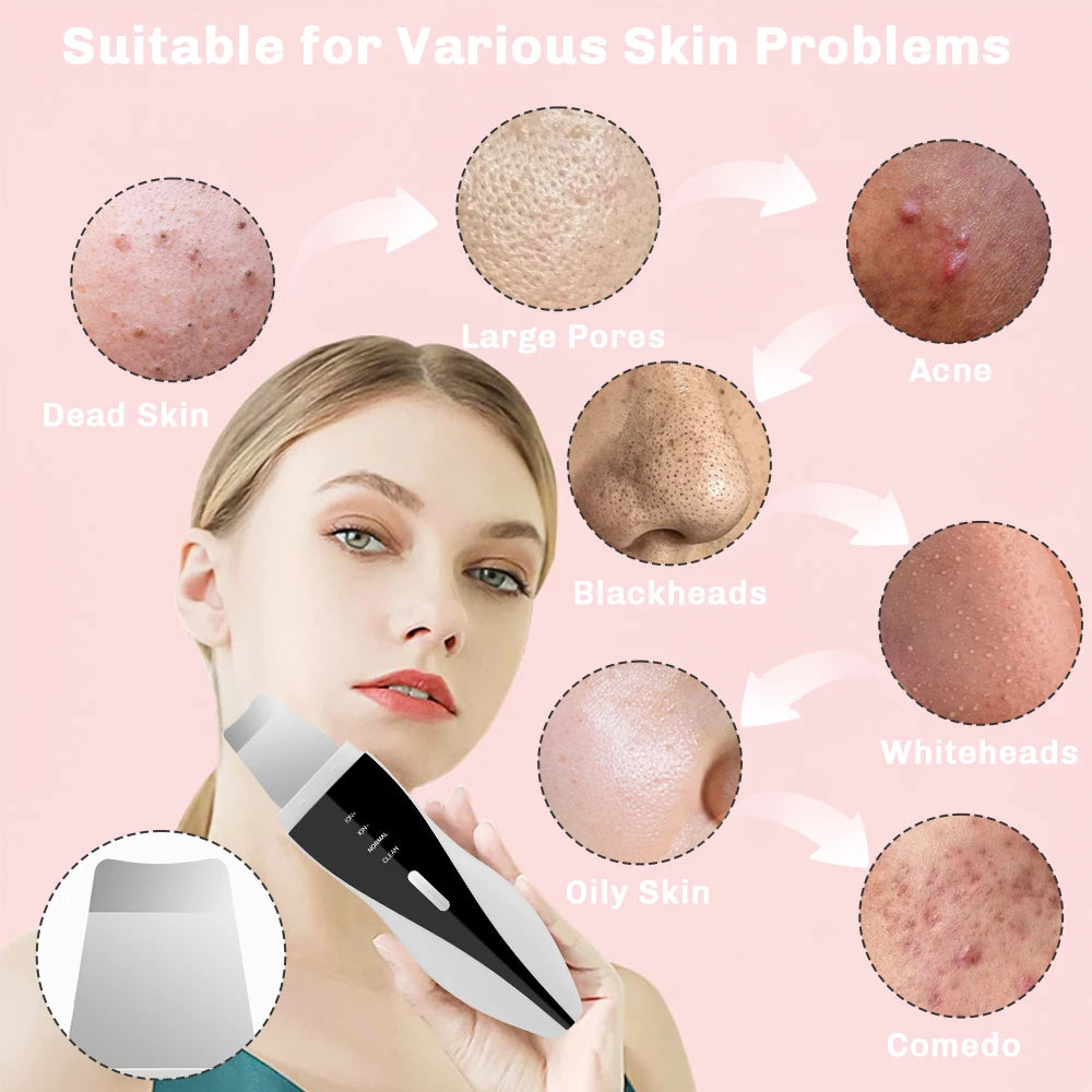 Ultrasonic Skin Scrubber Red Blue Light Deep Face Cleaning Peeling Blackhead Remover Facial Shovel Cleanser Lifting Skin Care