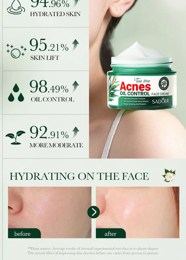 Tea Tree Acne Removing Cream Facial skincare Oil Control Face Gel Creams Hydrating Moisturizing Facial Cream Skin Care Set