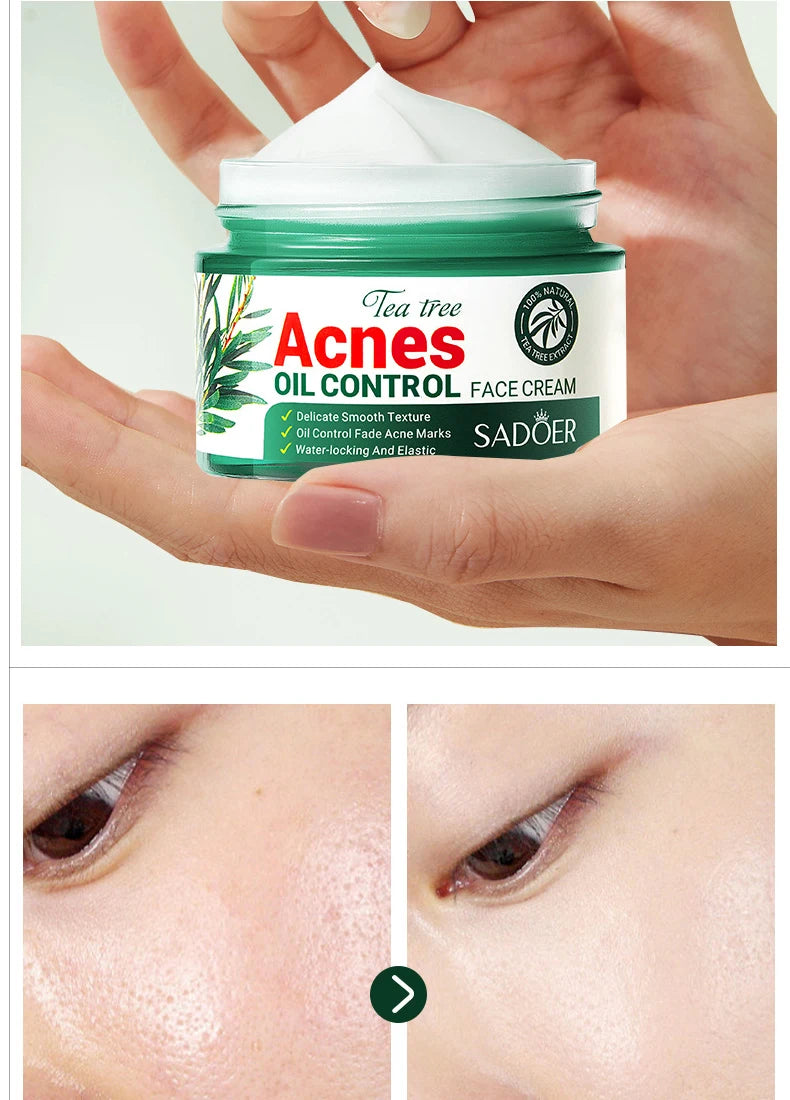 Tea Tree Acne Removing Cream Facial skincare Oil Control Face Gel Creams Hydrating Moisturizing Facial Cream Skin Care Set