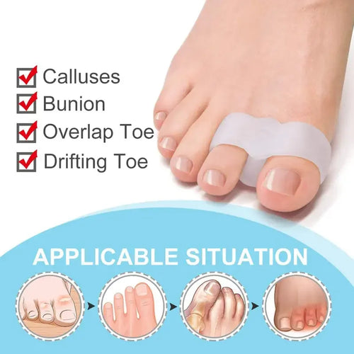 1 Pair Bunion Corrector - Relieve Pain and Correct Overlapping Toes - Suitable for Bunions