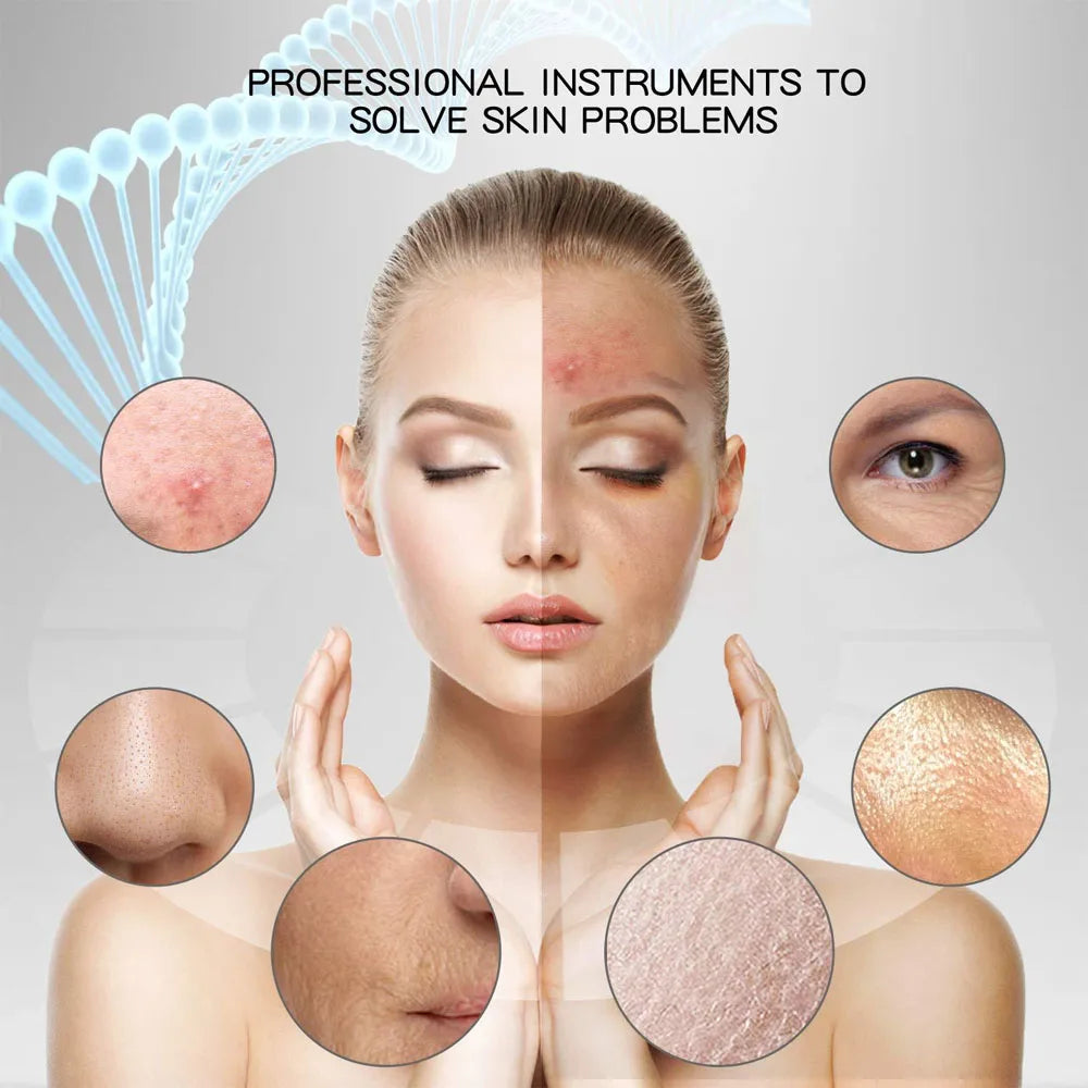 Ultrasonic Skin Scrubber Vibration Face Spatula Blackhead Remover Shovel Clean Cavitation Peeling Facial Lifting Skin Care
