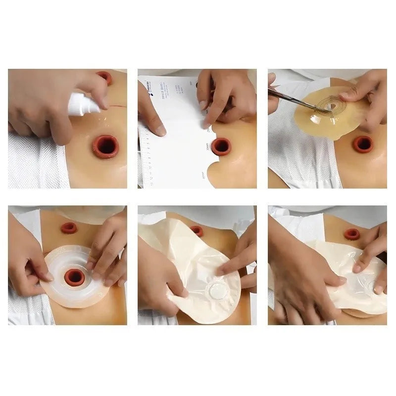 10pcs Disposable Colostomy Bag with Clip Set Stoma Drainage Bag