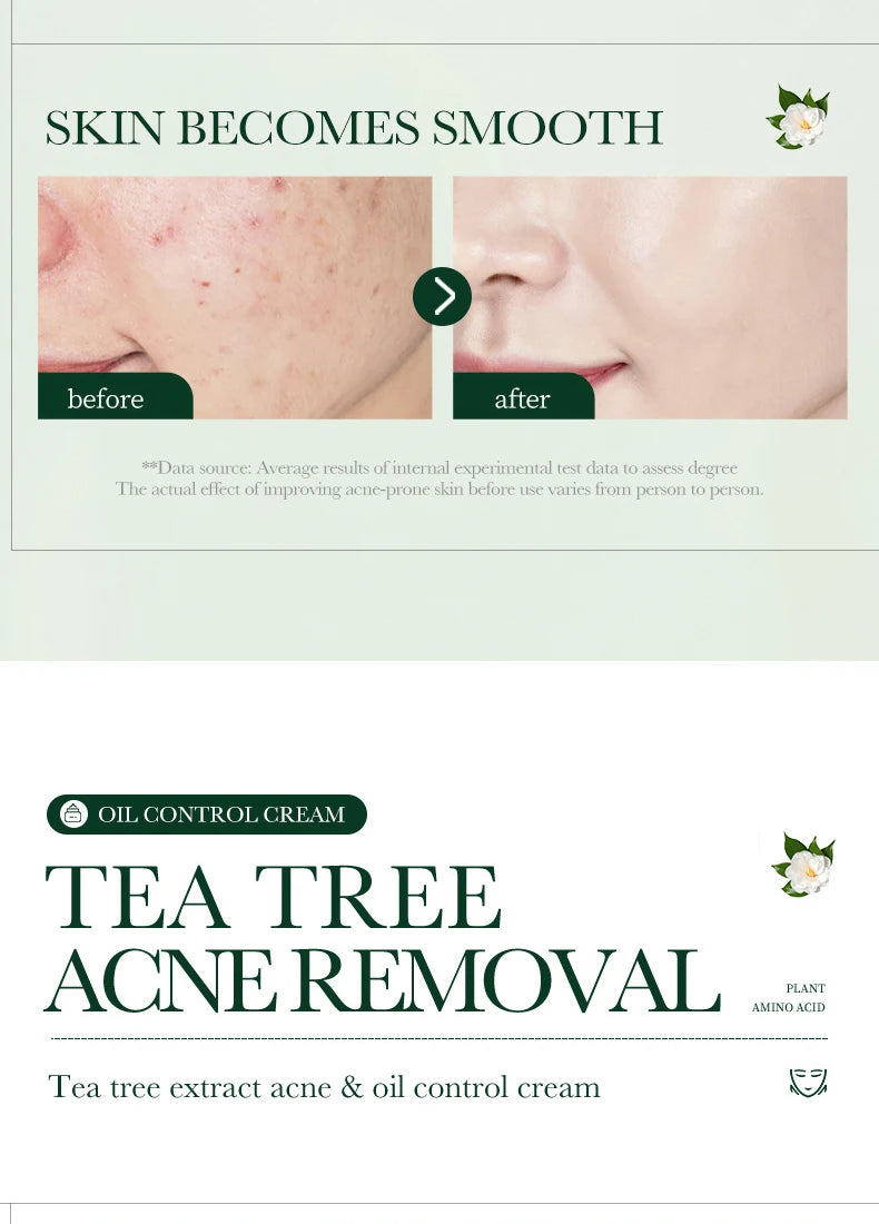 Tea Tree Acne Removing Cream Facial skincare Oil Control Face Gel Creams Hydrating Moisturizing Facial Cream Skin Care Set